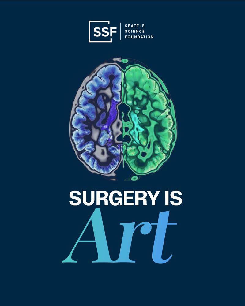 SSF artwork: a brain drawn in blue and teal above the words Surgery is Art.